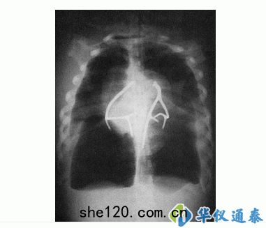 美(měi)國CIRS 602三維(wéi)軀幹(gān)模體(tǐ)